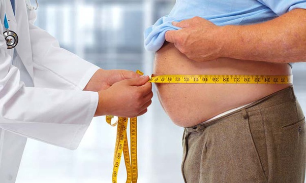 Low-cost and best bariatric surgery overview at Nav Imperial Hospital, Jaipur's renowned orthopedic healthcare center.