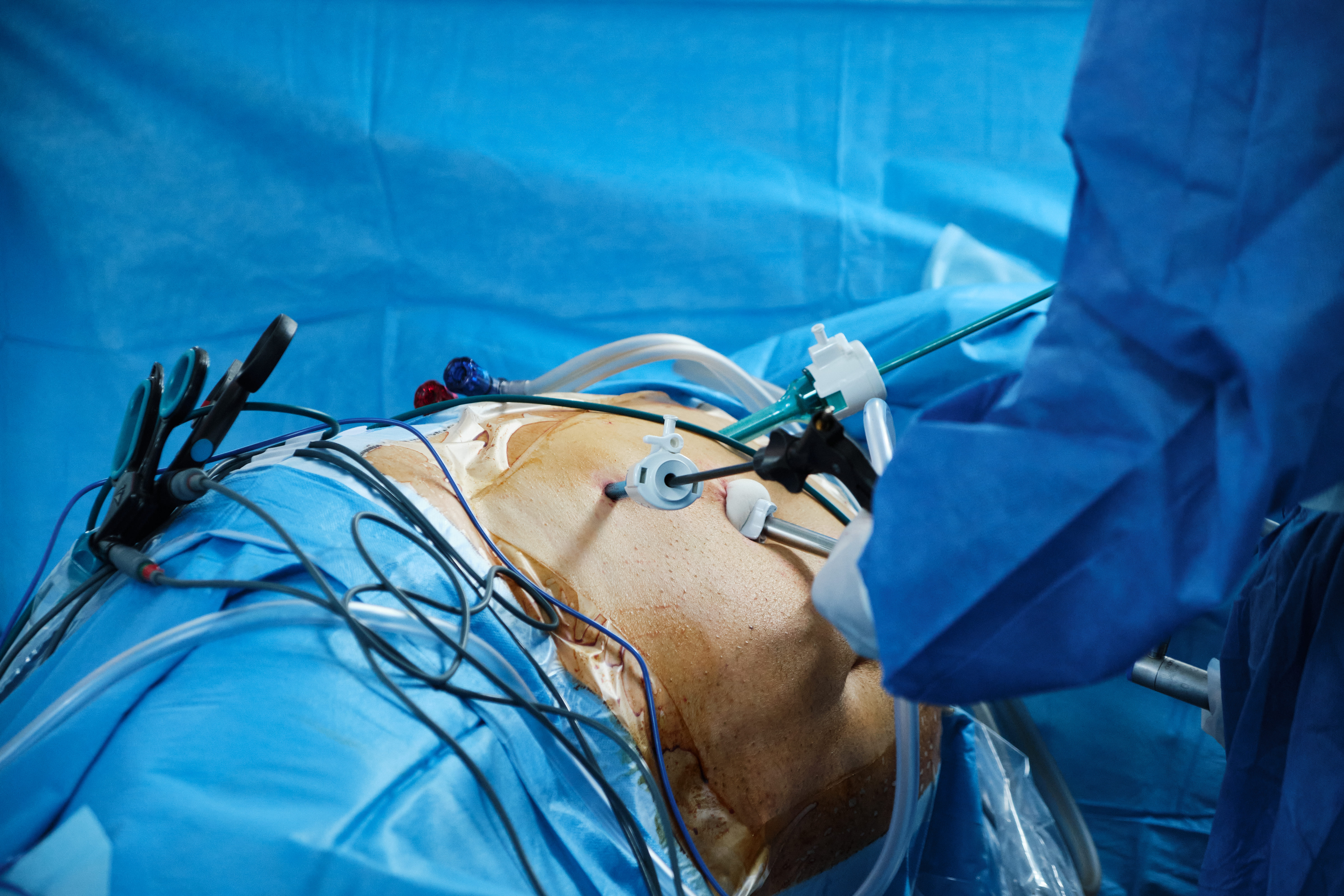 Pediatric surgery treatment